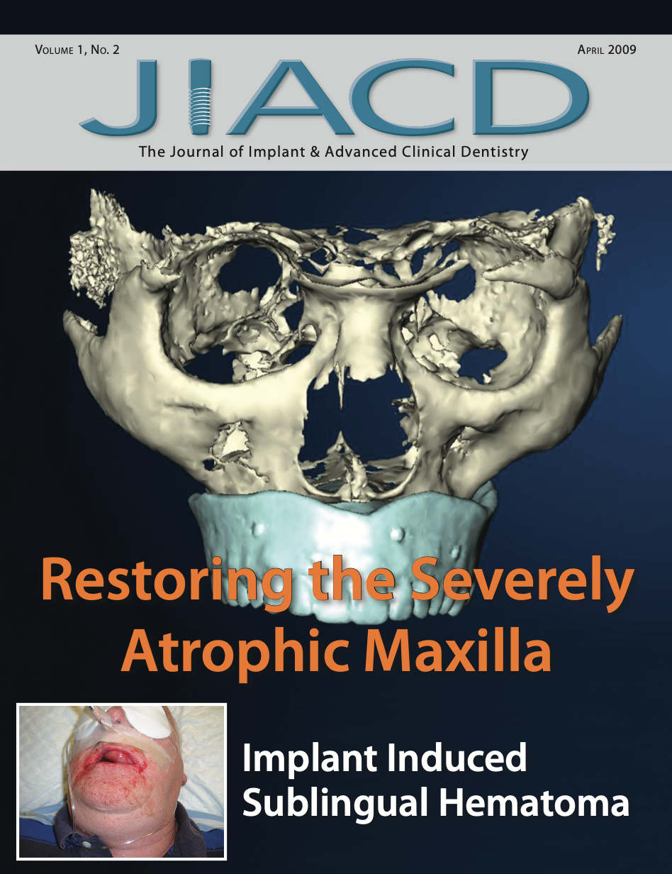 Restoring the Severely Atrophic Maxilla