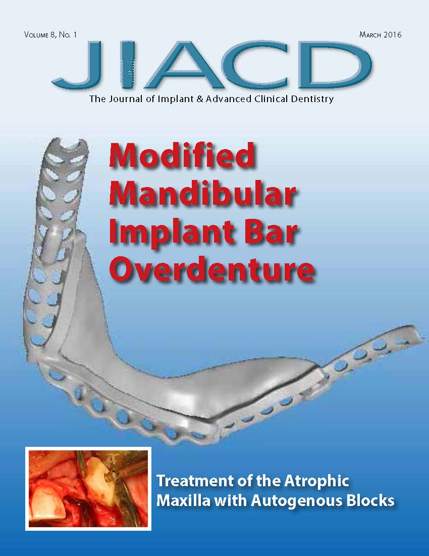 Modified Mandibular Implant Bar Overdenture