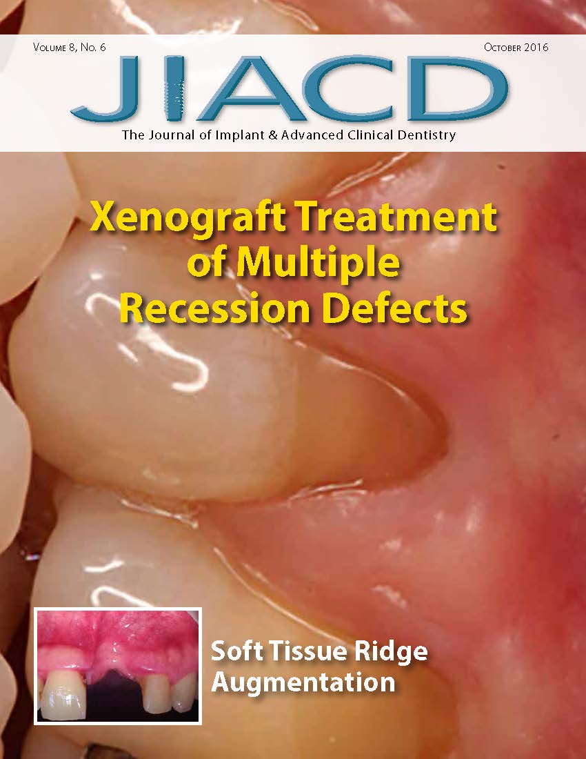 Xenograft Treatment of Multiple Recession Defects