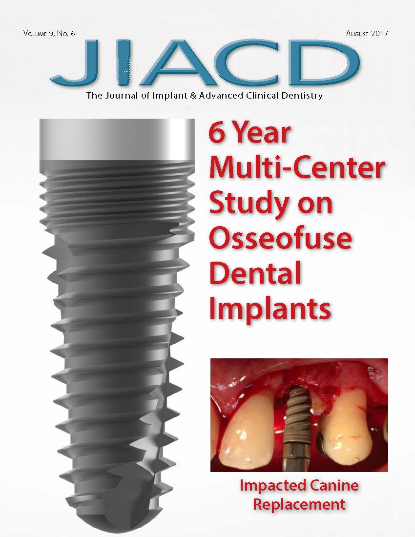 6 Year Multi-Center Study on Osseofuse Dental Implants