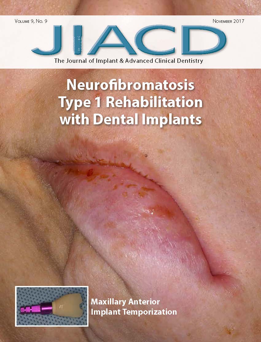 Neurofibromatosis Type 1 Rehabilitation with Dental Implants