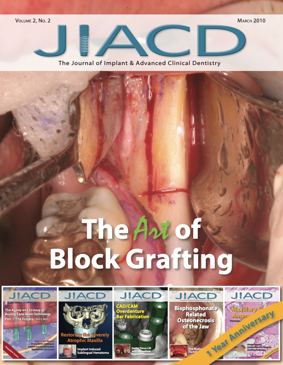 The Art of Block Grafting