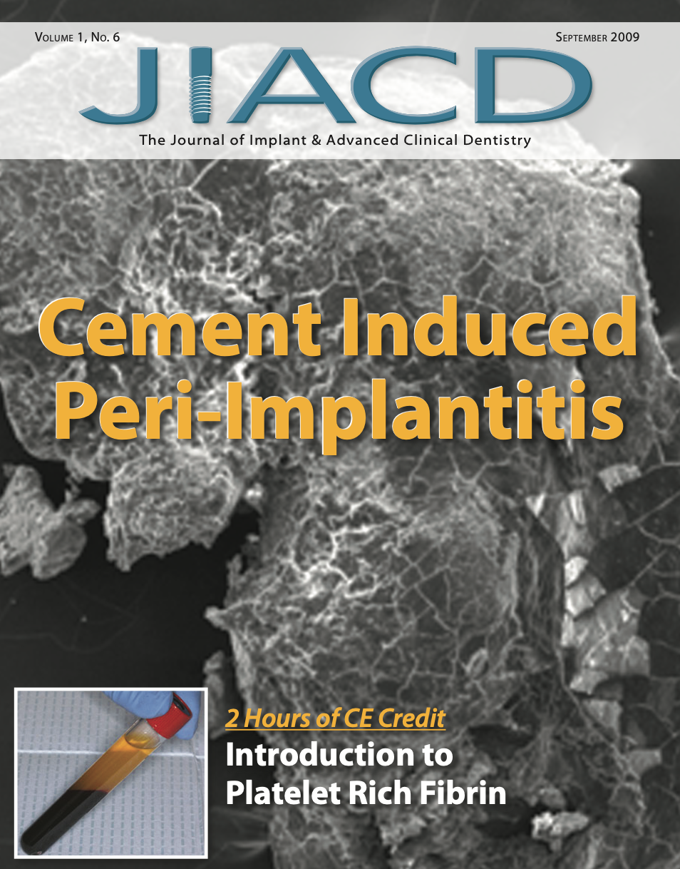 Cement Induced Peri-Implantitis